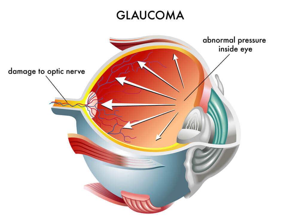 Eye Diseases Chart